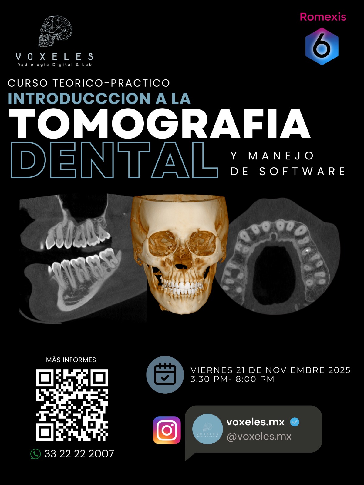 CURSO TEORICO-PRACTICO INTRODUCCCION A LA TOMOGRAFIA DENTAL NOVIEMBRE