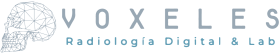 Voxeles